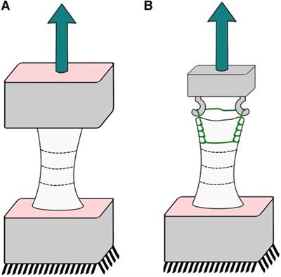 Investigating the effect of autograft diameter for quadriceps and patellar tendons use in anterior cruciate ligament reconstruction: a biomechanical analysis using a simulated Lachman test